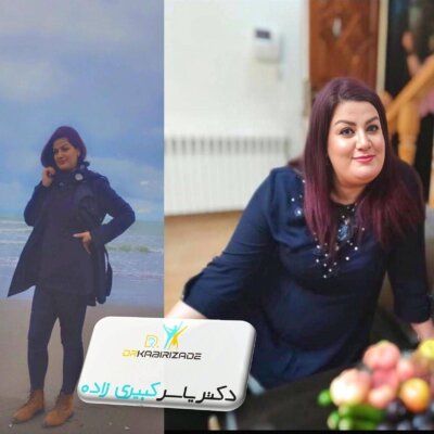 درمان قطعی چاقی با اسلیو معده در تهران
