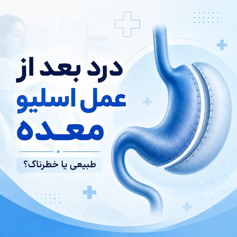 درد عمل اسلیو معده