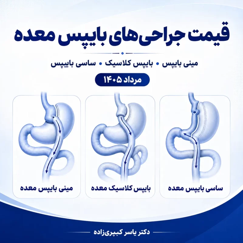 هزینه عمل بای پس معده 1 قیمت جراحی مینی بایپس معده، قیمت جراحی بایپس کلاسیک و قیمت عمل ساسی بایپس معده