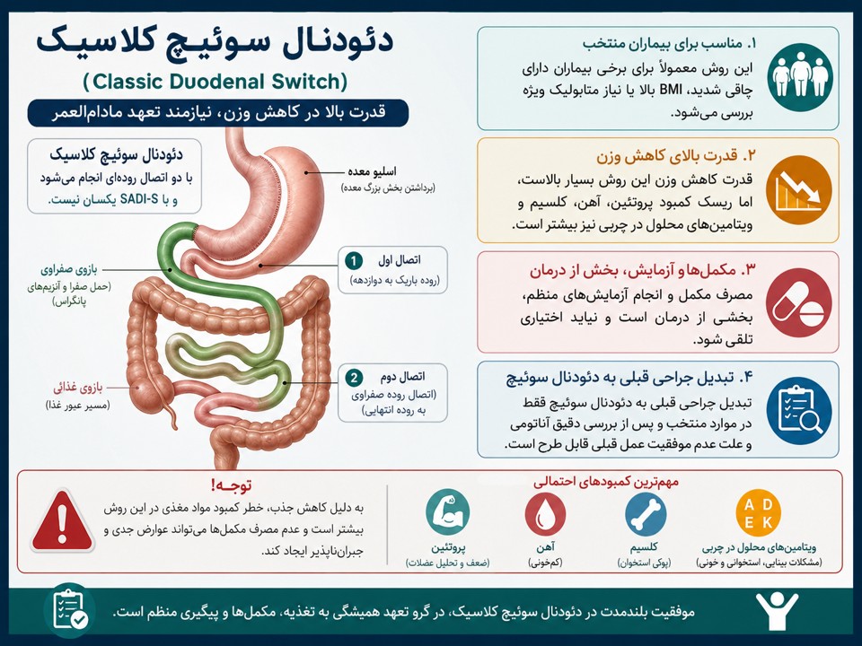 دئودنال سوییچ یا بایپس روده چیست؟