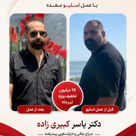 نظر افرادی که توسط دکتر یسار کبیری زاده عمل شده اند