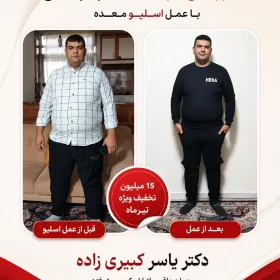 نظر افرادی که توسط دکتر یسار کبیری زاده عمل شده اند