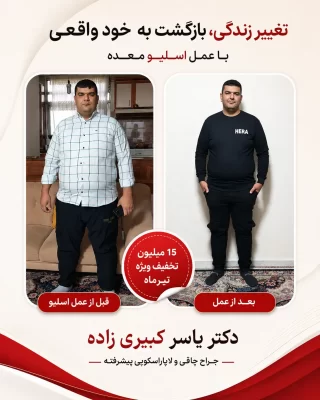 نظر افرادی که توسط دکتر یسار کبیری زاده عمل شده اند