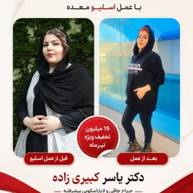 نتیجه بعد از اسلیو و بایپس افرادی که توسط دکتر یسار کبیری زاده عمل شده اند
