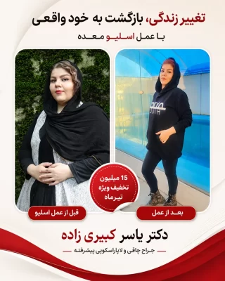 نتیجه بعد از اسلیو و بایپس افرادی که توسط دکتر یسار کبیری زاده عمل شده اند