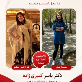 نظر افرادی که توسط دکتر یسار کبیری زاده عمل شده اند