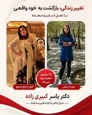 نظر افرادی که توسط دکتر یسار کبیری زاده عمل شده اند