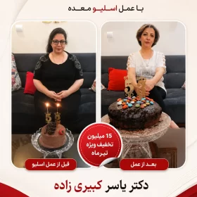 نظر افرادی که توسط دکتر یسار کبیری زاده عمل شده اند