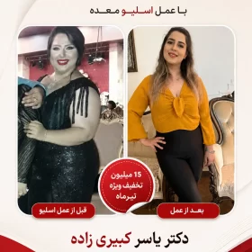 نظر افرادی که توسط دکتر یسار کبیری زاده عمل شده اند