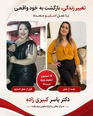 نظر افرادی که توسط دکتر یسار کبیری زاده عمل شده اند