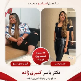 نظر افرادی که توسط دکتر یسار کبیری زاده عمل شده اند