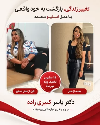 نظر افرادی که توسط دکتر یسار کبیری زاده عمل شده اند