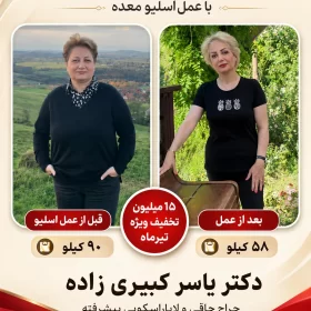 نظر افرادی که توسط دکتر یسار کبیری زاده عمل شده اند