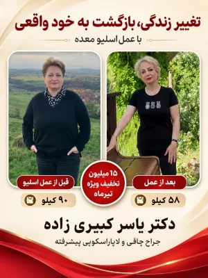 نظر افرادی که توسط دکتر یسار کبیری زاده عمل شده اند