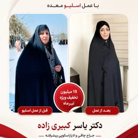 نظر افرادی که توسط دکتر یسار کبیری زاده عمل شده اند