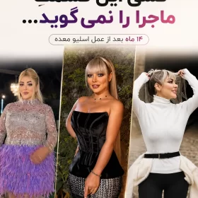 تجربه بعد از عمل اسلیو معده