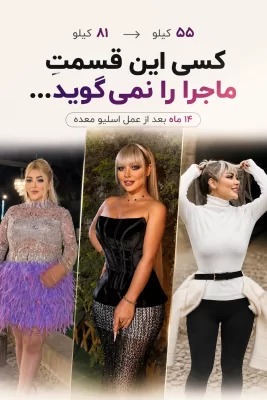 نتیجه بعد از اسلیو و بایپس افرادی که توسط دکتر یسار کبیری زاده عمل شده اند