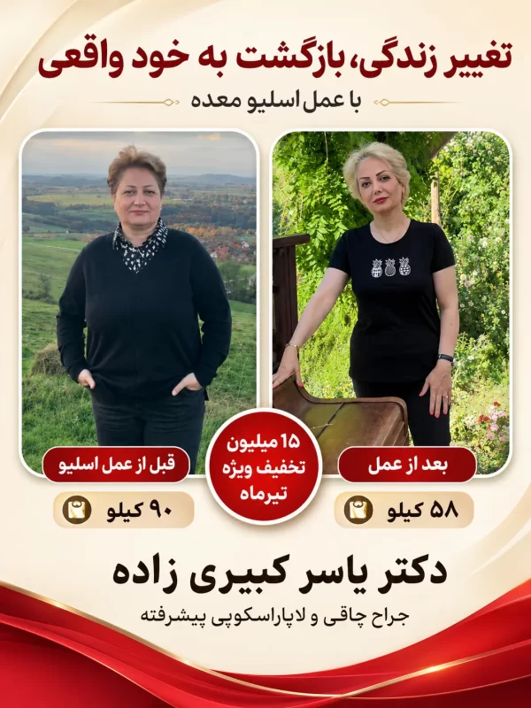 تجربه از عمل اسلیو معده