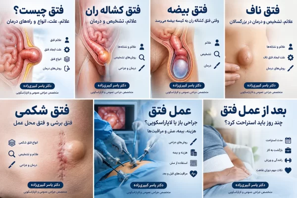 فتق کشالع ران