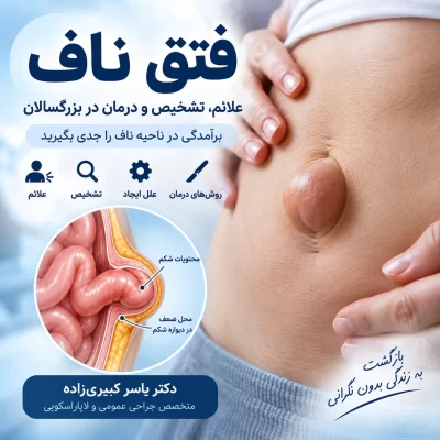 فتق ناف